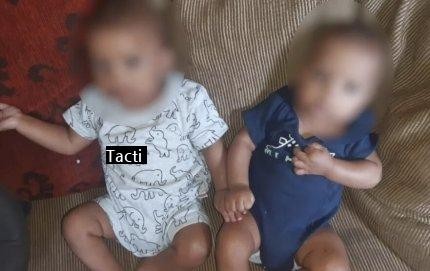 ブラジルで生まれた双子の父親が違う医師は非常に珍しいケース