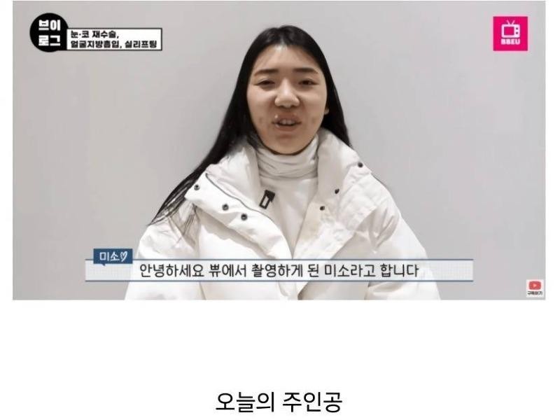韓国で整形手術を受けた日本人女性の顔jpg