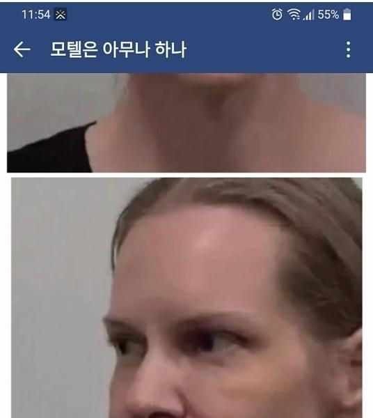 童顔になりたくて韓国に来た外国人女性jpg