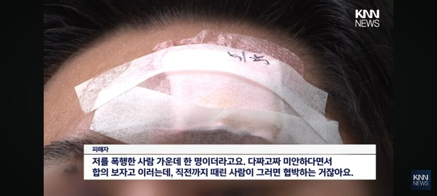 [ニュース]釜山警察、市民無差別暴行した暴力放置