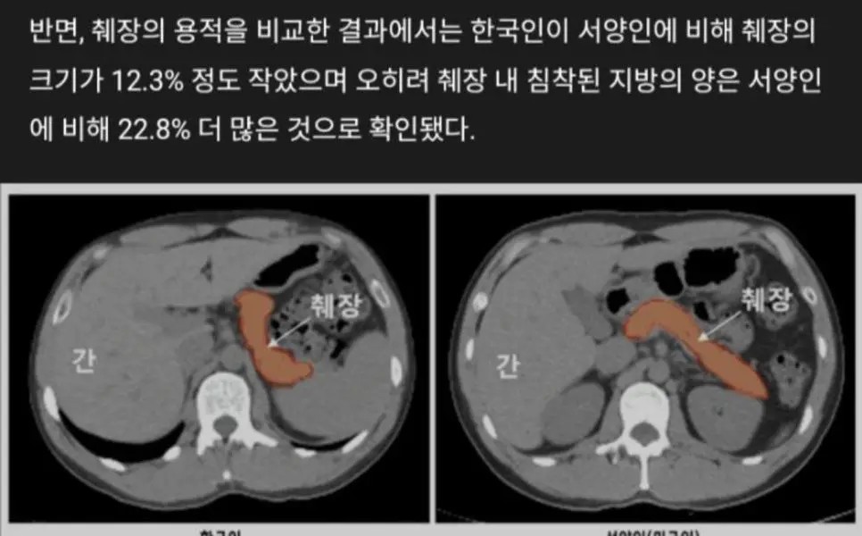 小さくてかわいい韓国人の膵臓、その特別な魅力