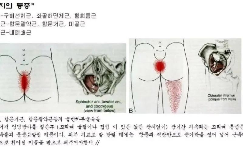 肛門に直接指を入れる脊椎矯正術