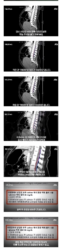 29歳の女性が出産中に死亡した衝撃的なケース