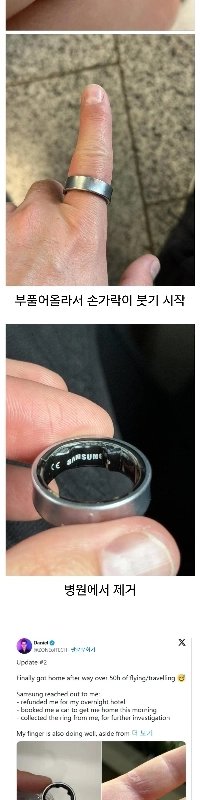 サムスンスマートリングのために緊急治療室の間のイギリス人