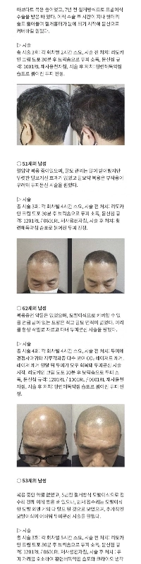 タトゥー手順の合法化、医師対オリエンタルドクター