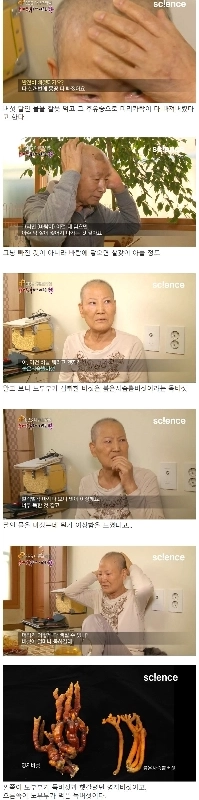 毒キノコを食べて髪が抜けた老夫婦