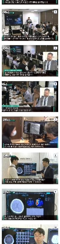 人間 vs AI 脳卒中診断バトル