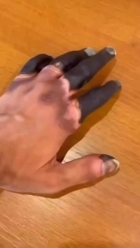 (SOUND)【嫌い】指が凍傷になった登山者