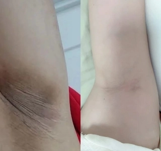 汚れを取り除く