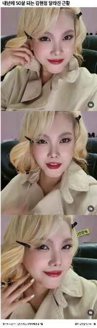 顔がすっかり変わってしまったキム・ヒョンジョンの現在
