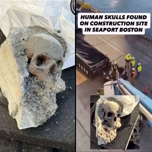 (SOUND)恥）コンクリート補修作業中に、へこみのある人間の頭蓋骨が発見された。