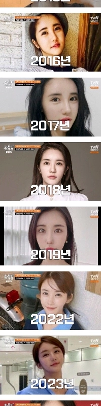 整形手術に3億ウォンを費やした女性