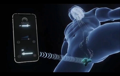 (SOUND)19) 早漏患者への朗報.gif