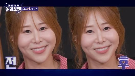 目を編集しますか？やるととてもきれいになると言われるコメディアン