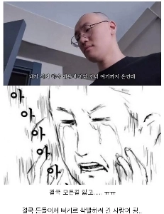 男性が毛髪移植のためにトゥルキエへ行った