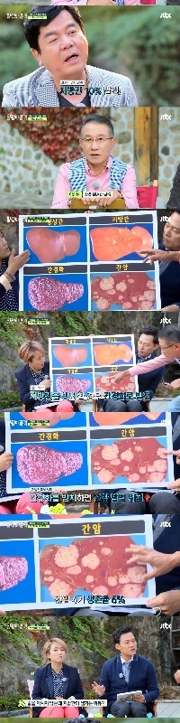 お酒を飲まなくても脂肪肝になる理由