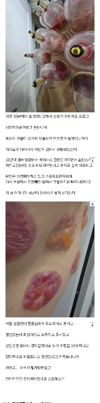 ヘイト) なぜ無認可の医療行為はこんなに危険なのかㄷㄷㄷㄷ