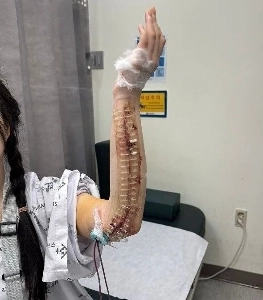 憎）「おい、腕蹴ったら折れちゃうよ」