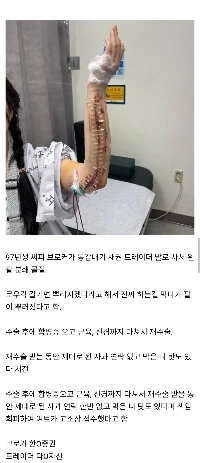 嫌い）「「」「おい、蹴ったら腕が壊れるよ」「」」彼は実際にそれをやった。