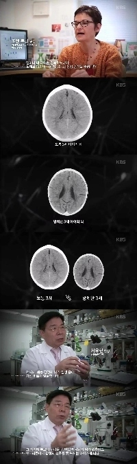 2～3歳の子どもが愛情を受けなかったらどうなるでしょうか？