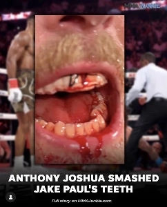 ジェイク・ポールの現状は少し深刻なようだ。