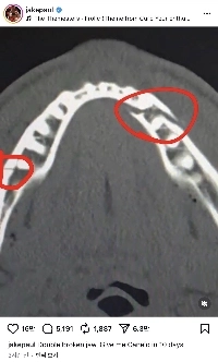 ジェイク・ポール ジョウボーン 江南3洞ㄷㄷ(feat.X-ray)