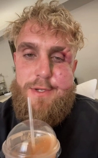 試合後のジェイク・ポールの最新情​​報