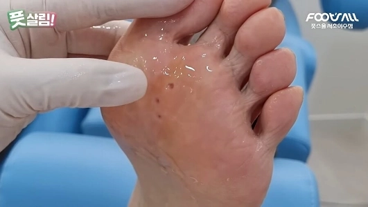 トウモロコシの除去前と除去後