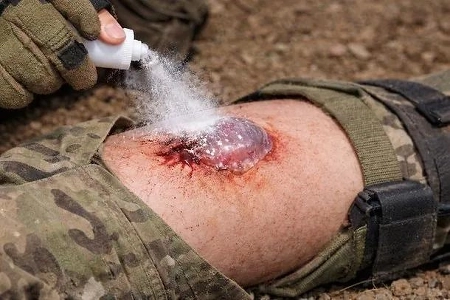 「「」「スプレーすれば１秒で出血が止まります」「」「… KAISTが開発した医療技術の正体ㄷㄷㄷㄷㄷㄷㄷ