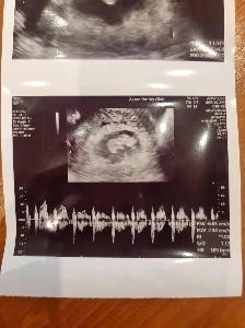 順調に育っています