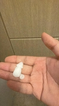 治療に時間がかかりすぎる