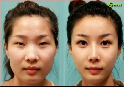 形成外科の力はすごいですね。