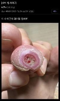 (ヘイト主義) コーンギャラリーの新興勢力が台頭