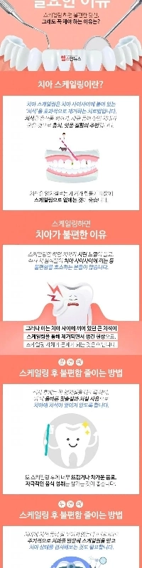 歯のスケーリングが必要な理由