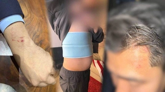 ランニングシューズ ホカ本社。暴行事件に関連した配給会社との契約解除。