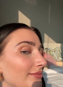 外国で史上初の鼻手術成功