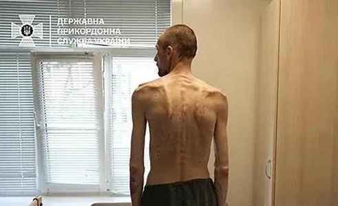 2年ぶりに帰還したウクライナ人囚人の様子